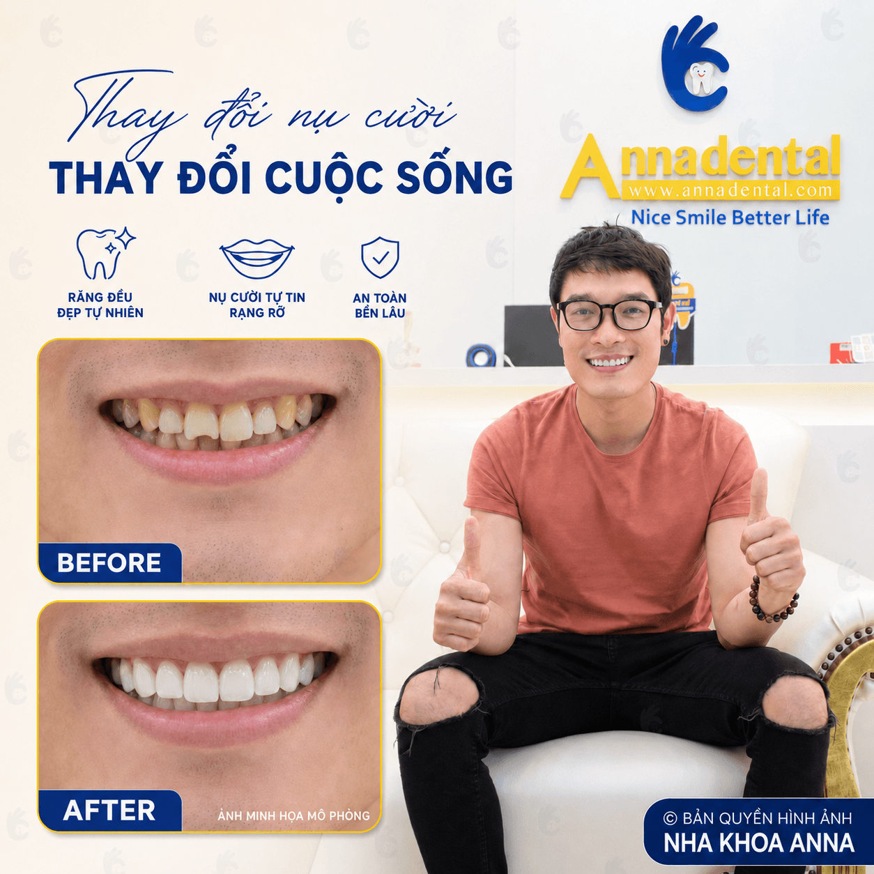 Before - After
