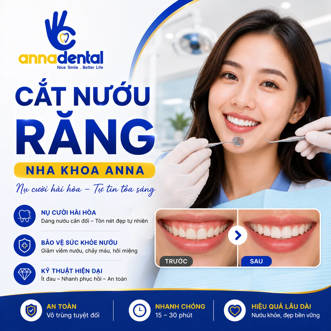 Cười hở lợi là gì nguyên nhân phổ biến