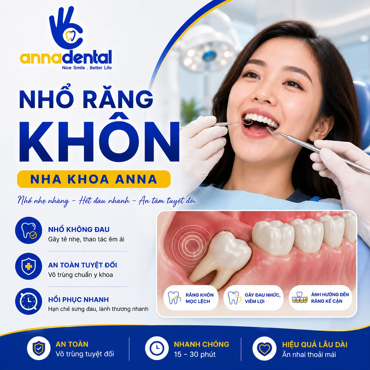 Nhổ Răng Khôn Có Đau Không? Chi Phí Bao Nhiêu?