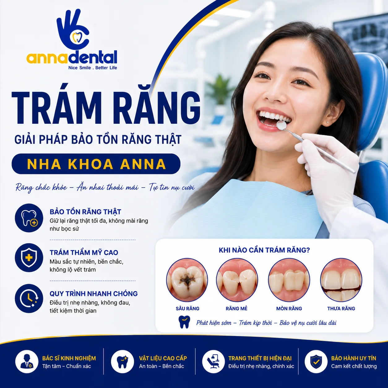 Trám Răng Là Gì? 5 Điều Cần Lưu Ý Khi Trám Răng