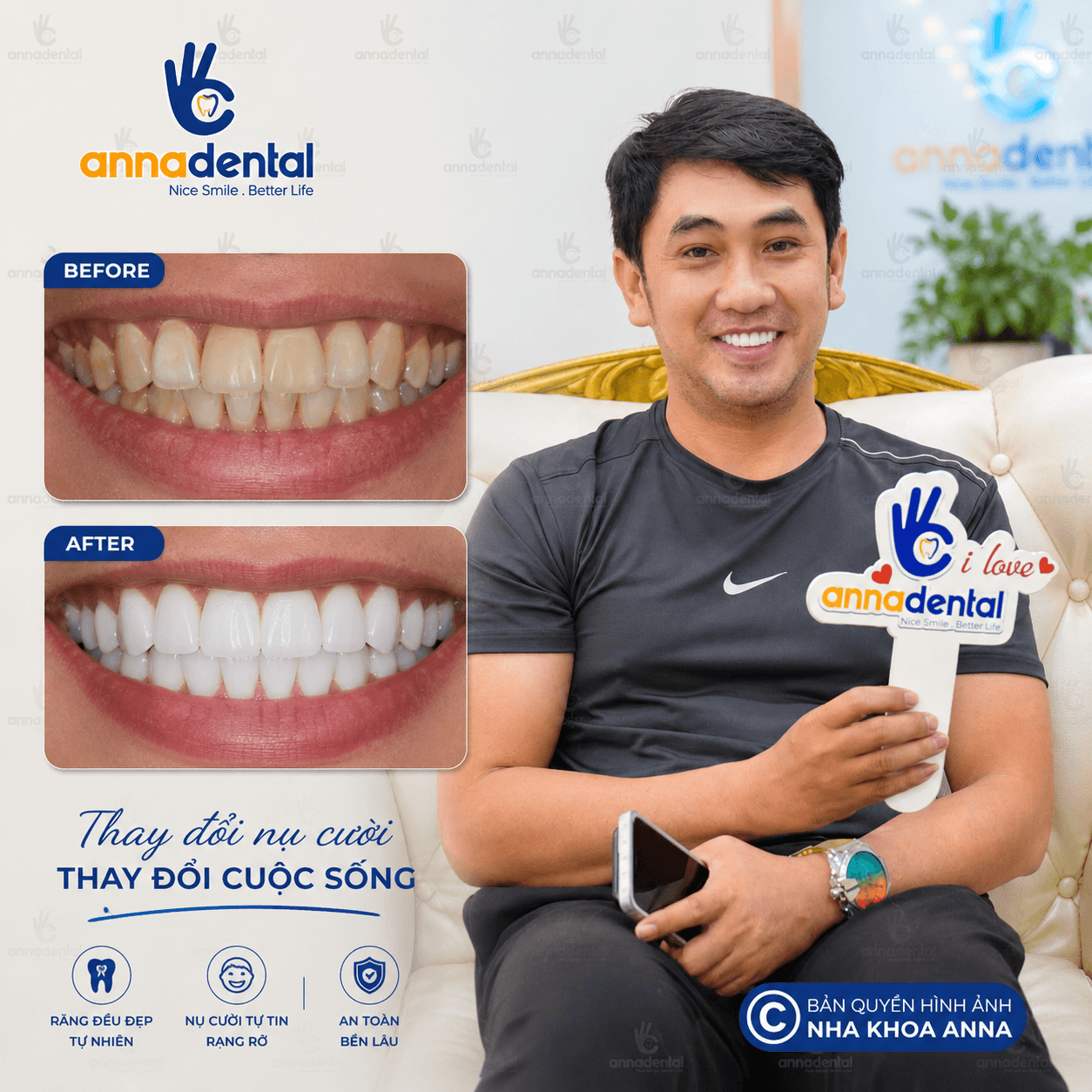 Anh Hoàng Nam Chia Sẽ Bọc Răng Sứ Tại Anna