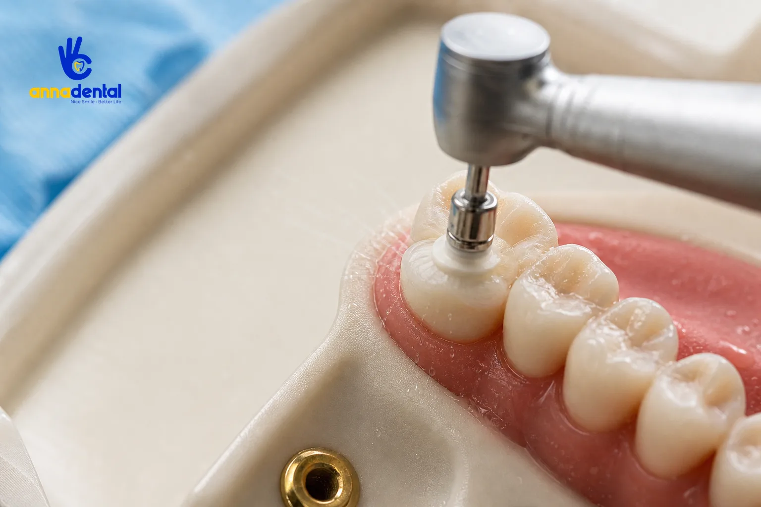 Cận cảnh mài răng thật trên mẫu hàm với dụng cụ nha khoa