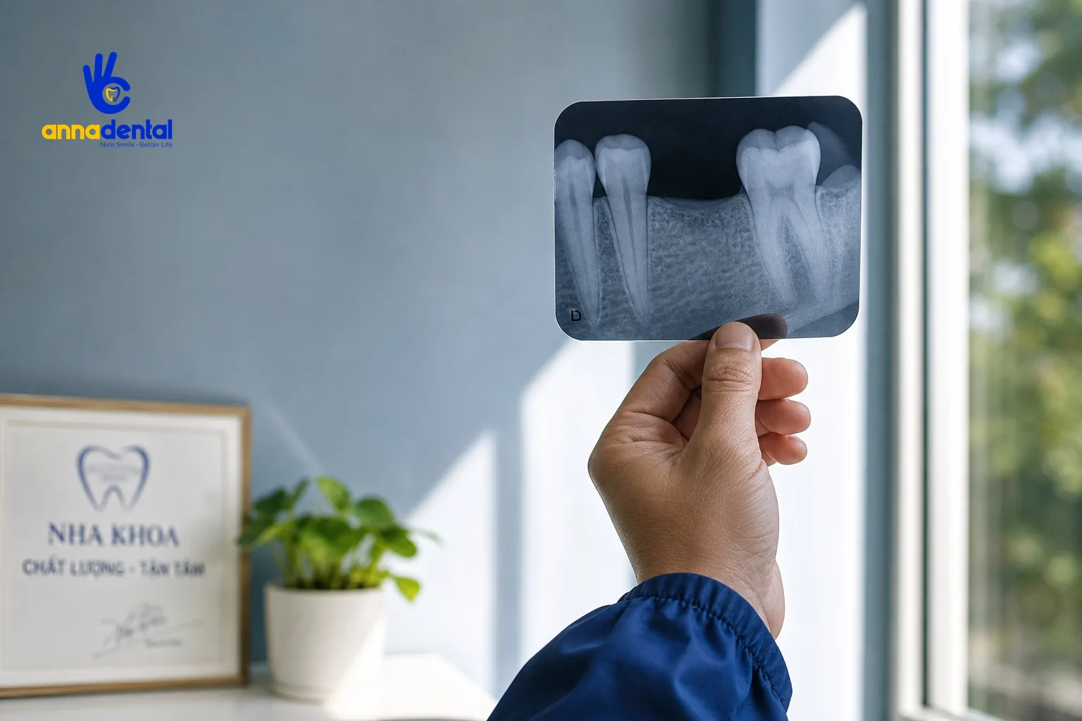 Bàn tay bác sĩ cầm phim X-quang kiểm tra vùng mất răng và răng trụ