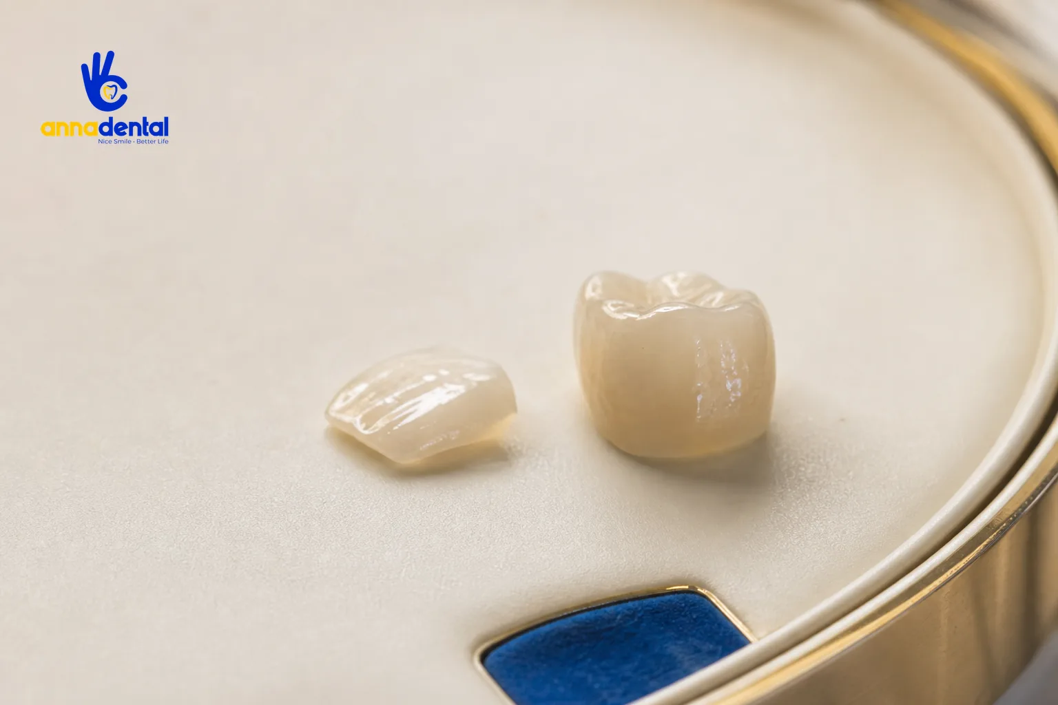 So sánh hai mẫu răng sứ: veneer mỏng và mão sứ dày trên khay