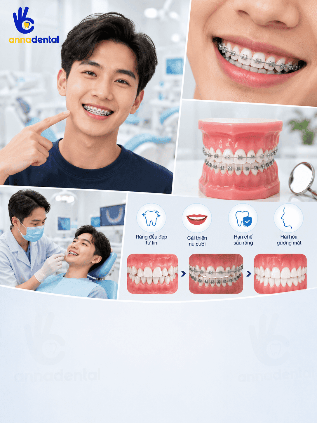 Niềng Răng Thẩm Mỹ 