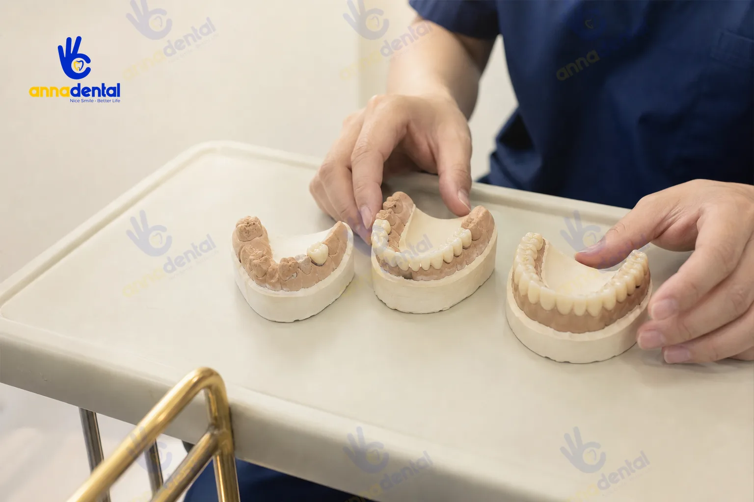 Ba mẫu hàm trình bày các phạm vi bọc sứ khác nhau trên khay nha khoa