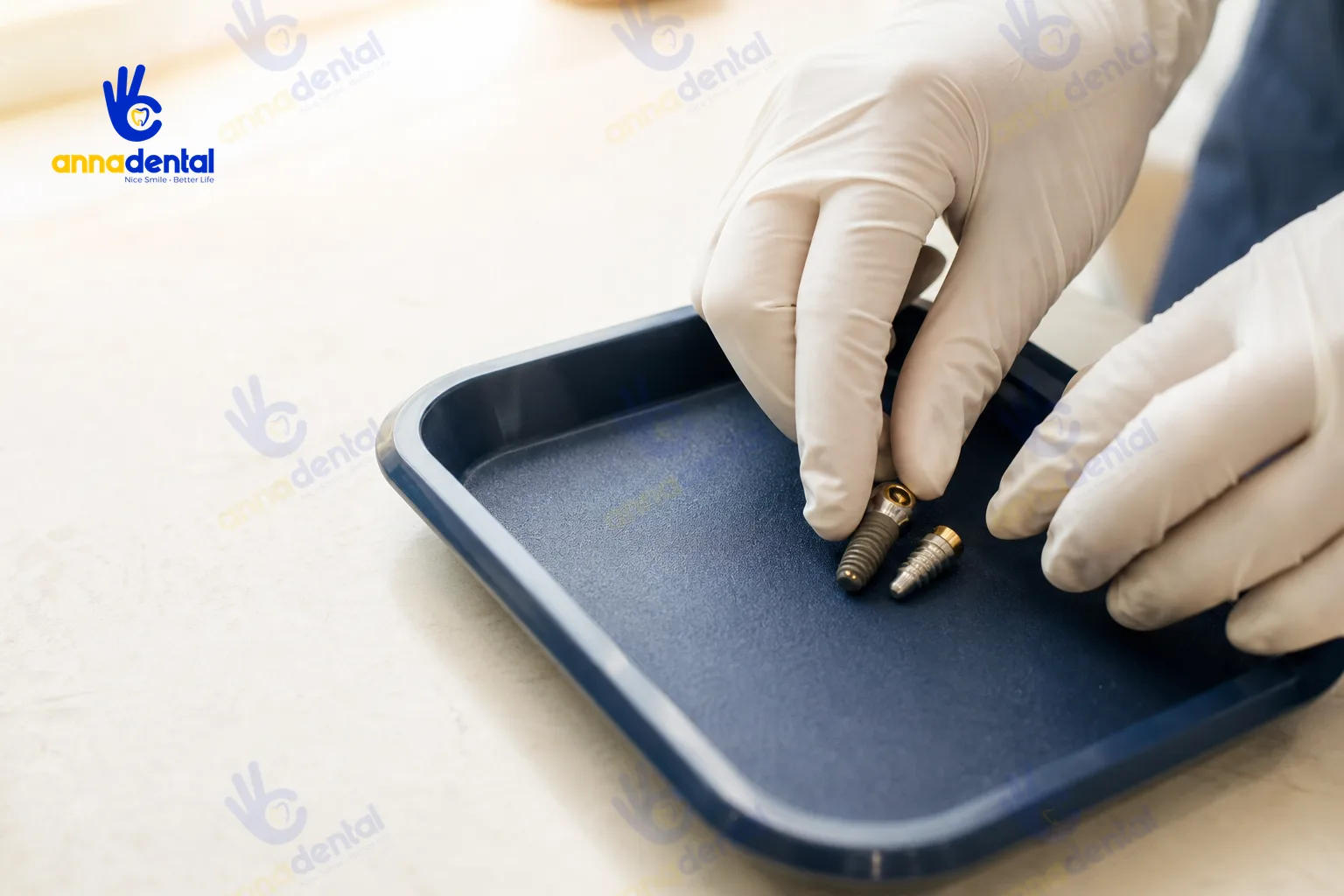 Tay bác sĩ sắp xếp hai trụ implant Hàn Quốc Biotem và Megagen trên khay xanh navy