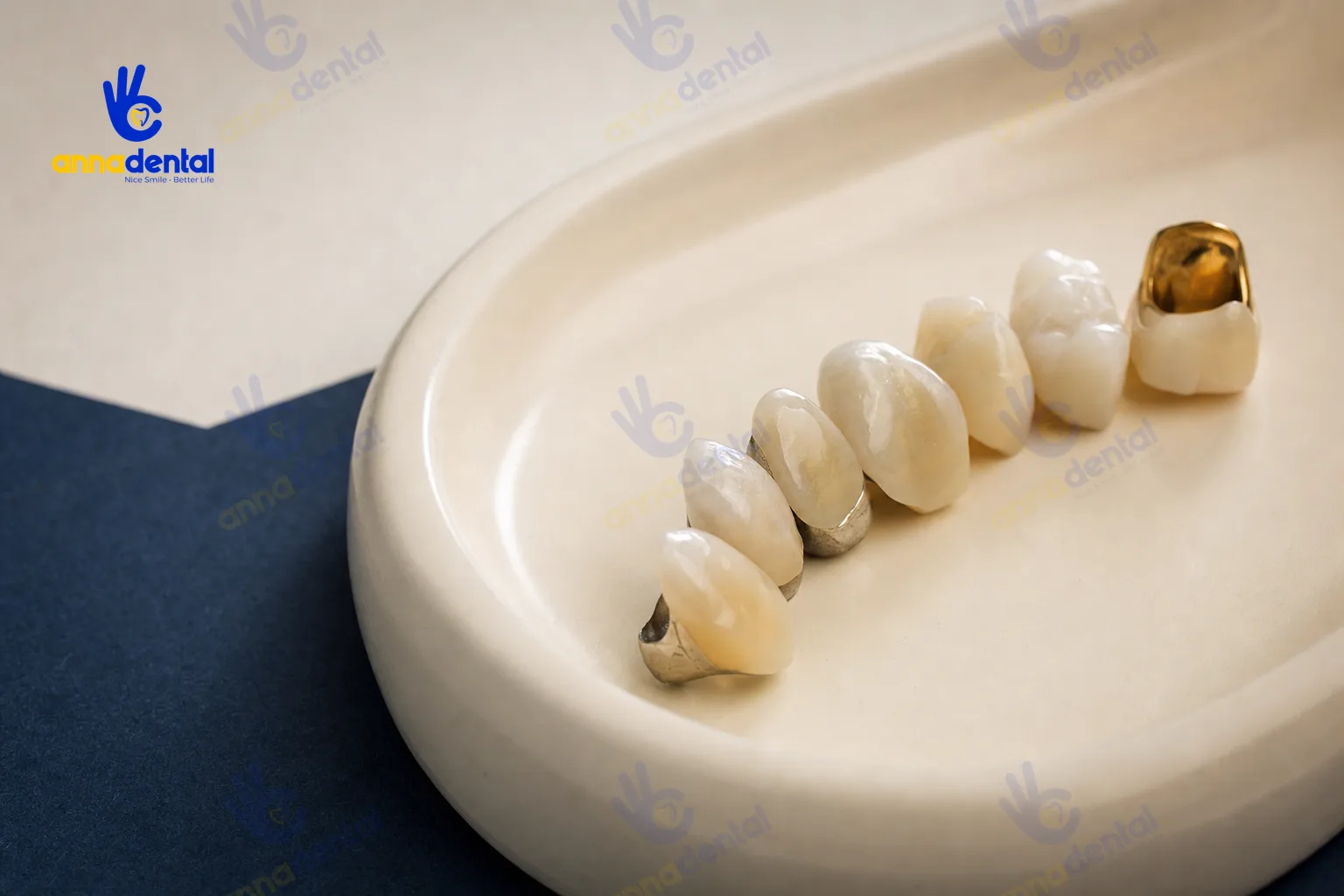 Cận cảnh các loại răng sứ khác nhau xếp trên khay nha khoa