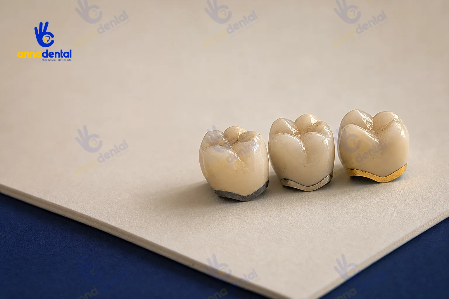 Ba mão răng sứ kim loại thường, Titan và kim loại quý đặt cạnh nhau