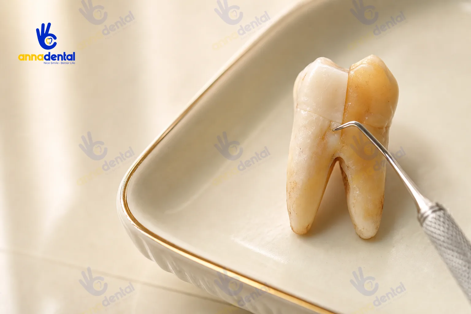 So sánh răng bị ố vàng ngoại lai và ố vàng nội sinh trên mẫu thật