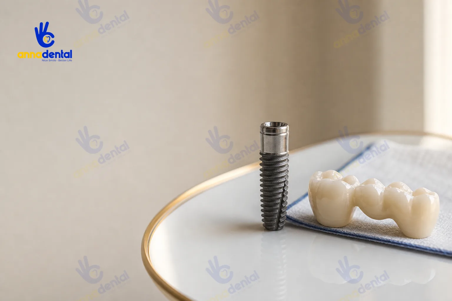 So sánh cận cảnh cấu tạo trụ Implant và cầu răng sứ thật
