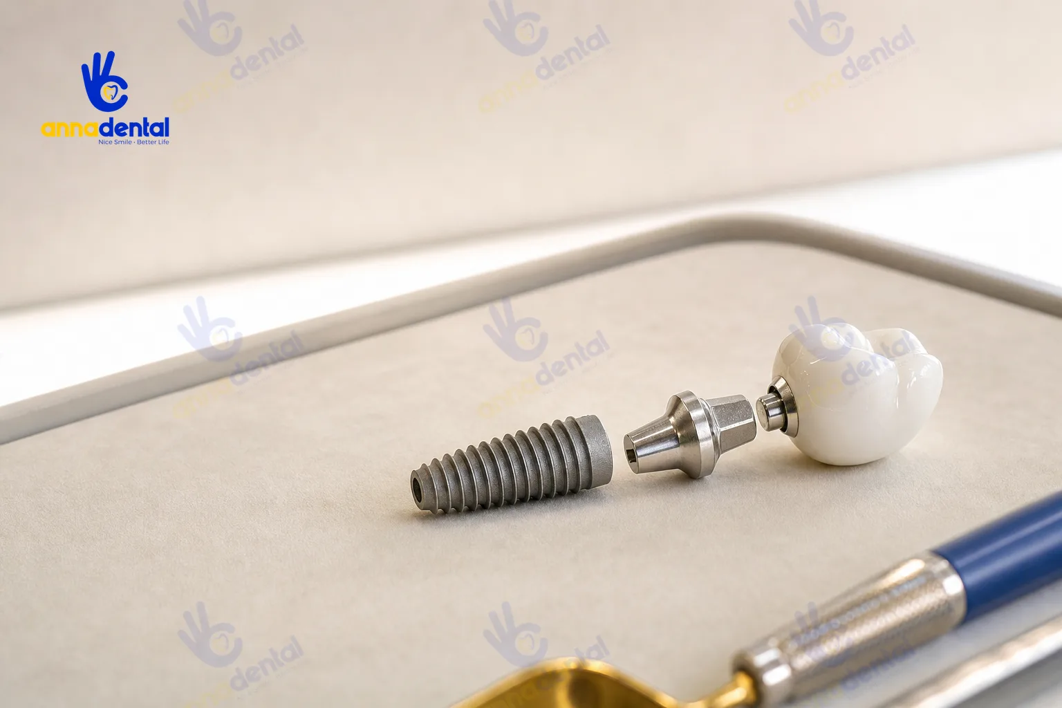 Mô phỏng cận cảnh cấu tạo implant với trụ, abutment và mão sứ