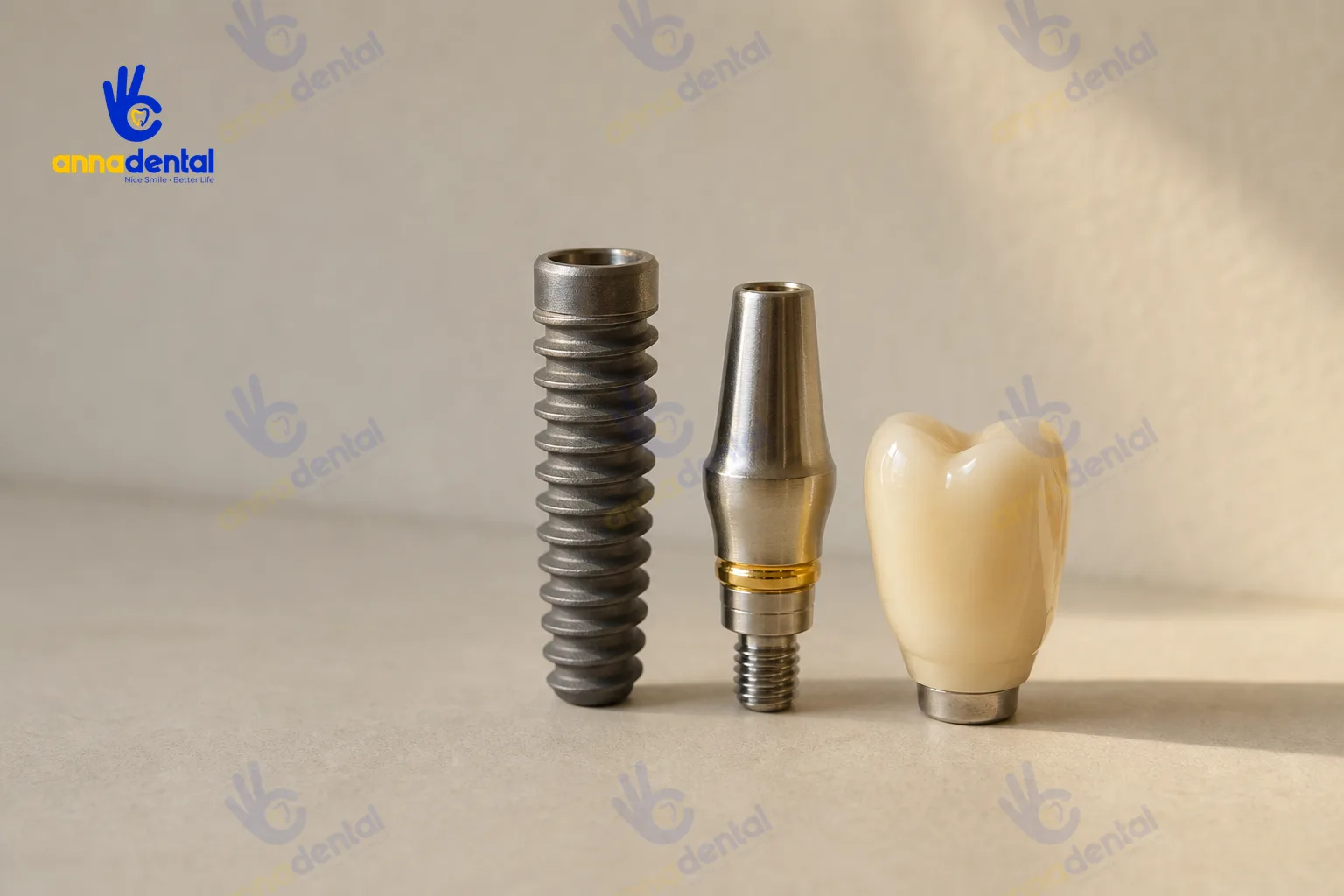 Ba thành phần răng implant thật gồm trụ titanium, abutment và mão sứ