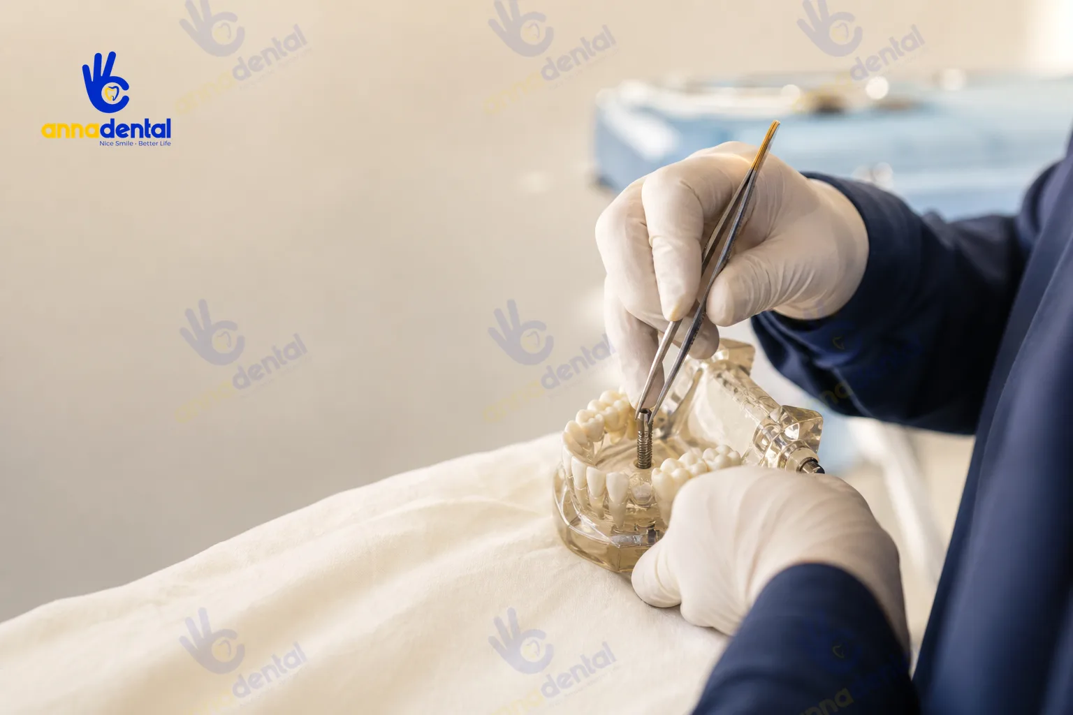 Bác sĩ thao tác cấy trụ trên mẫu hàm trong quy trình cấy ghép implant tức thì
