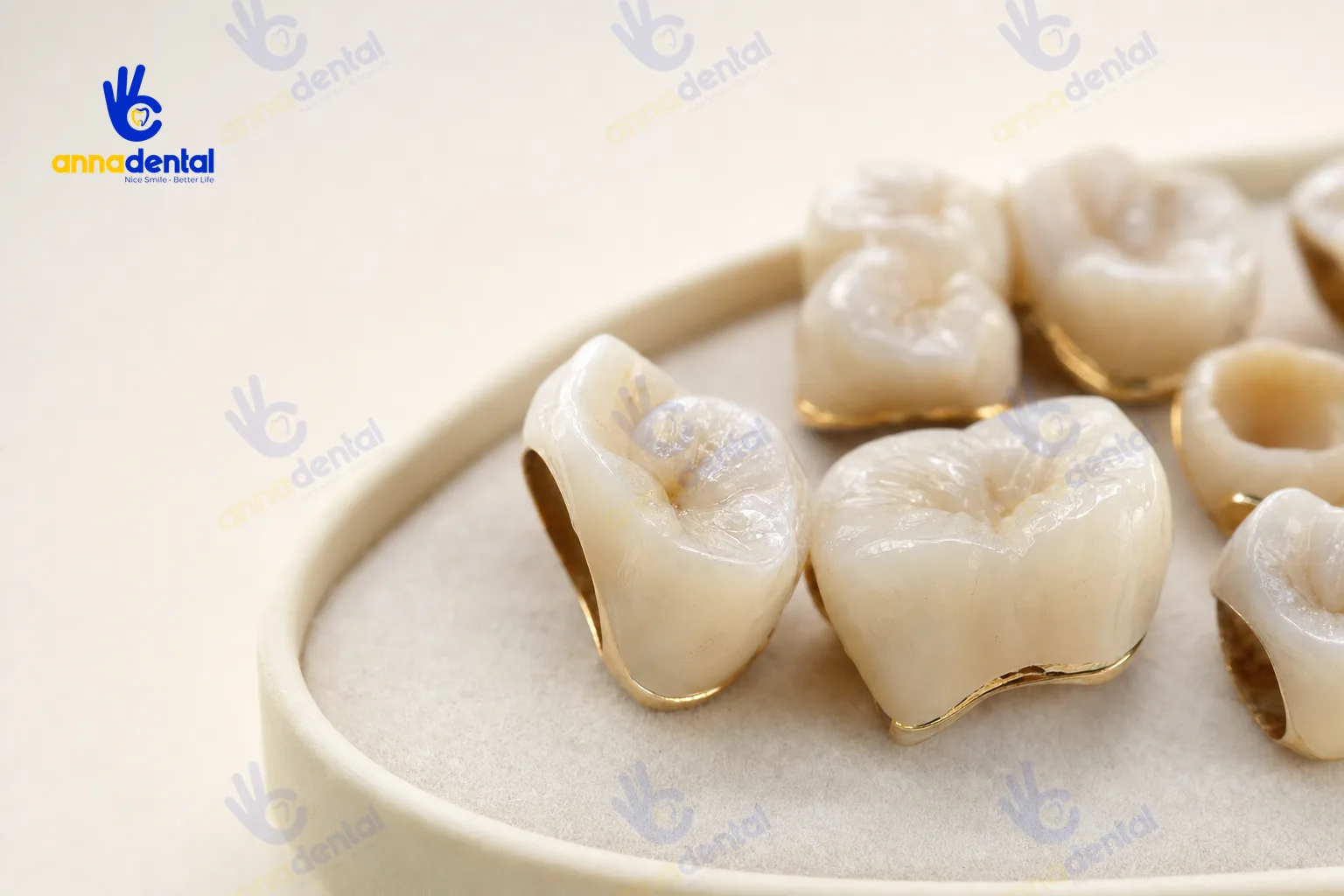 Cận cảnh mão sứ nha khoa minh họa chăm sóc răng sứ đúng cách