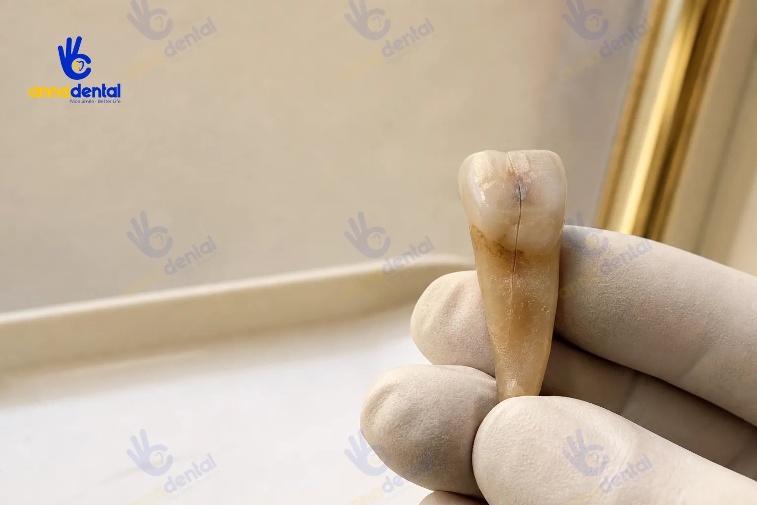 Chữa tủy răng cửa: quy trình, mức độ đau và chi phí thực tế