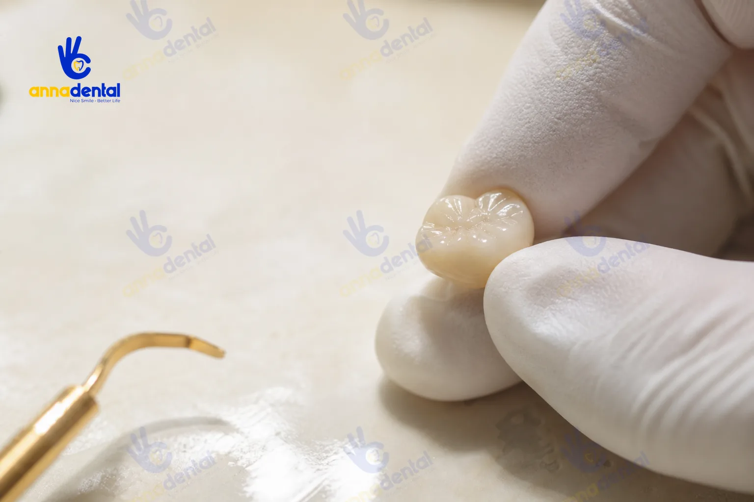 Chữa tủy răng đã bọc sứ: quy trình thực hiện và hướng xử lý