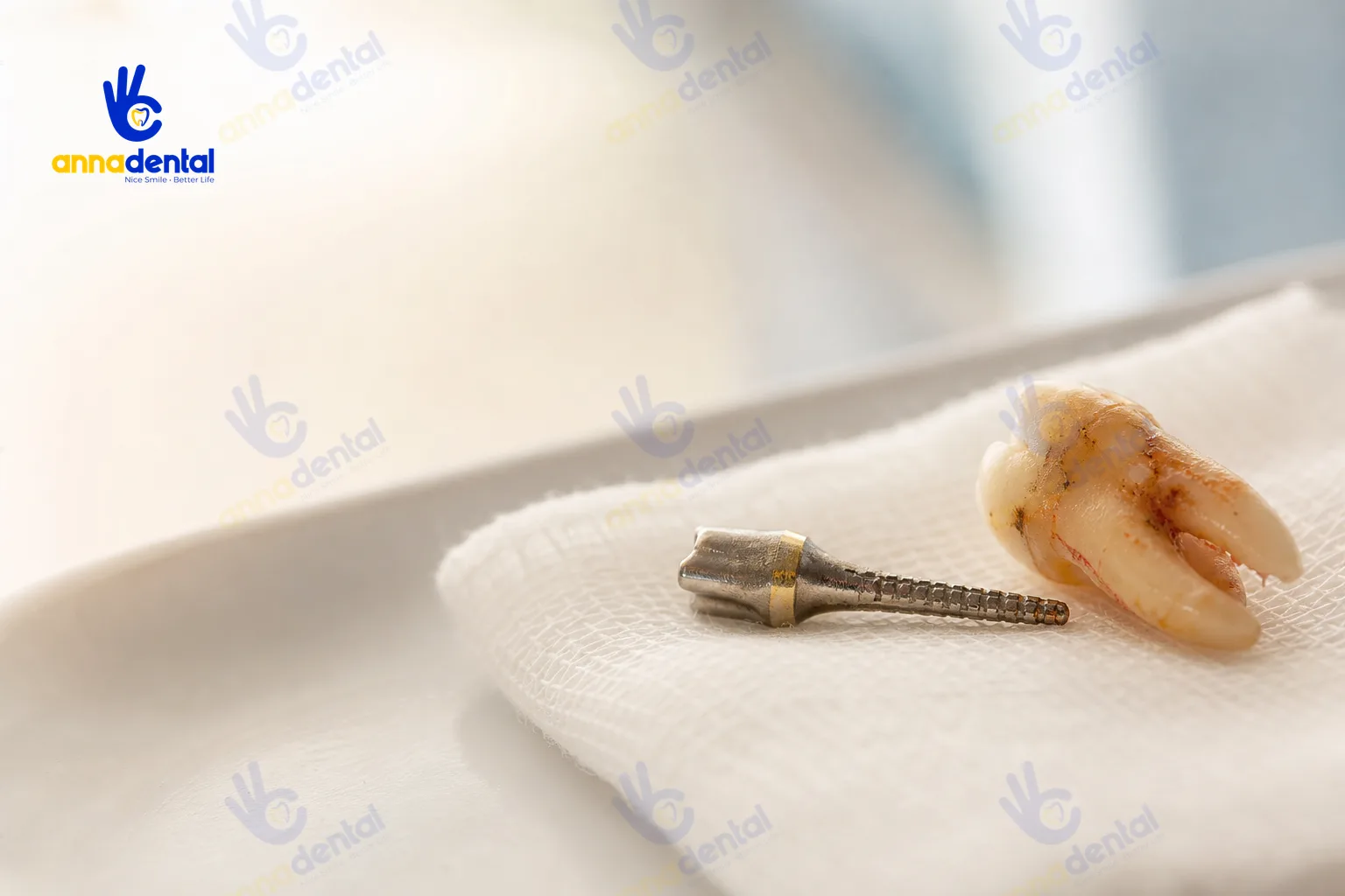 Chốt răng và chân răng đặt trên khay gauze vô trùng