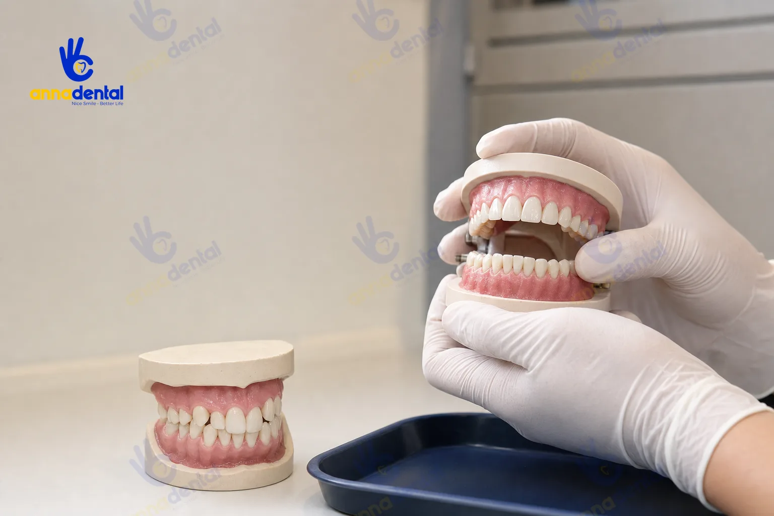 So sánh mô hình bọc sứ 4 răng cửa và răng lệch cần niềng