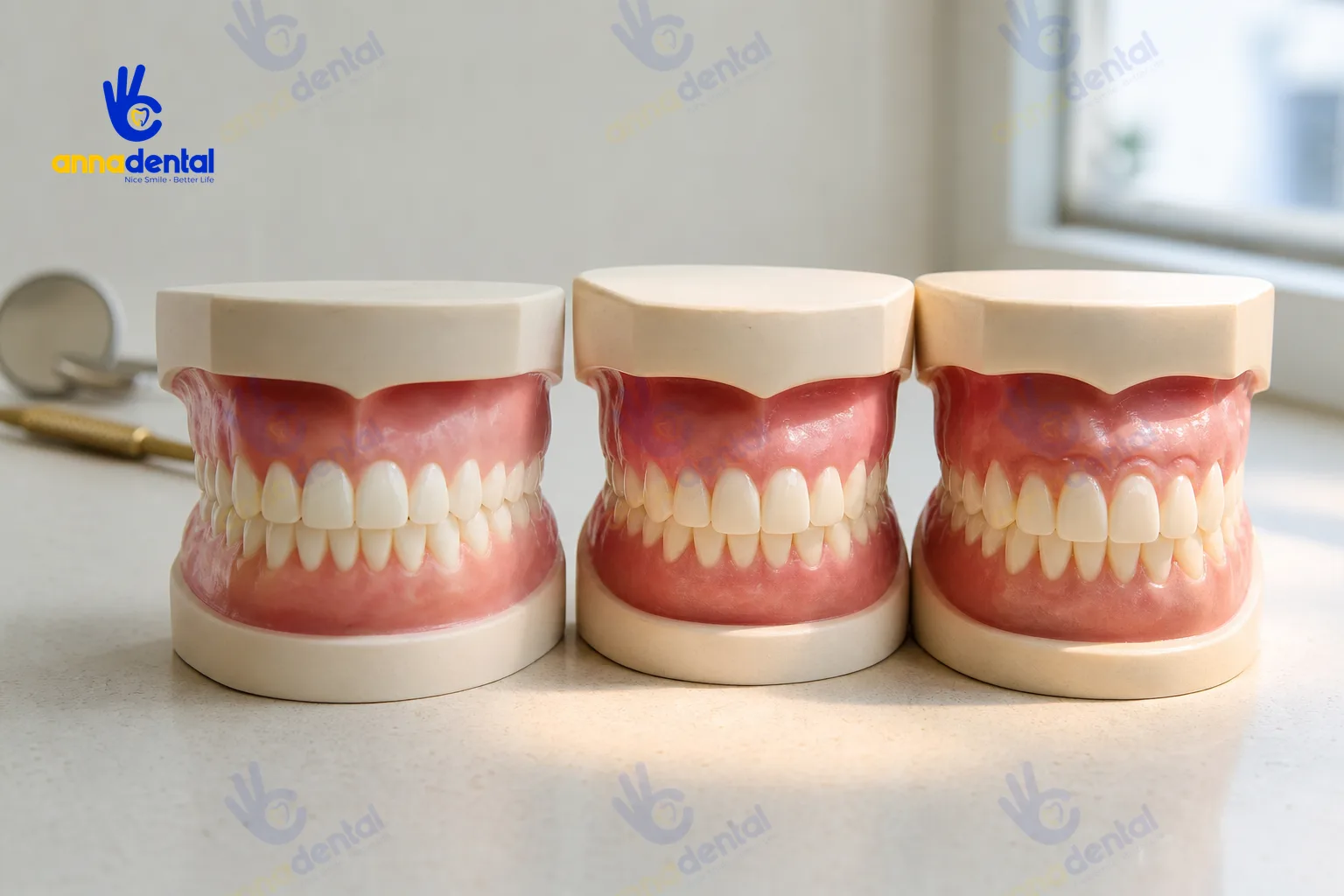 So sánh ba mẫu mô răng với mức độ lộ nướu khác nhau khi cười