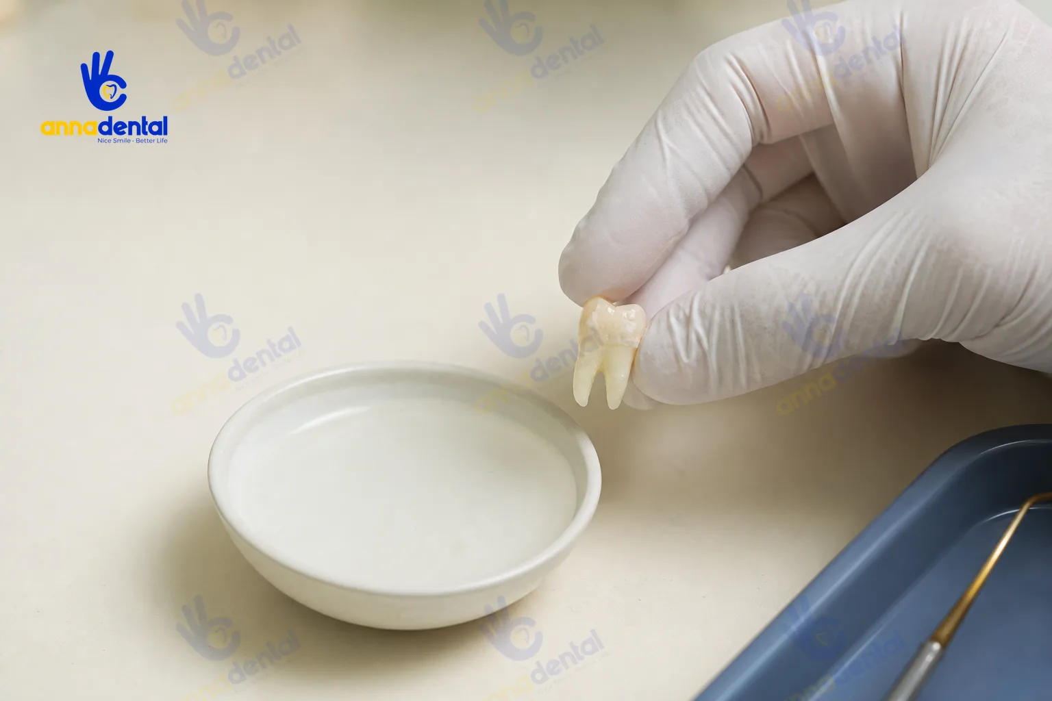 Tay bác sĩ giữ răng gãy chuẩn bị bảo quản đúng cách trước sơ cứu