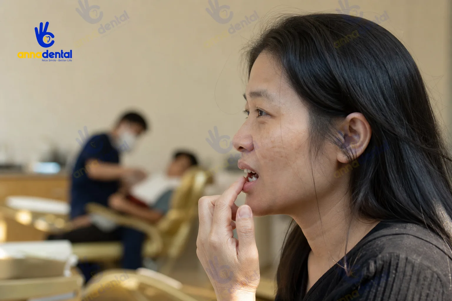 Bệnh nhân chạm môi, lộ rõ khoảng trống mất răng cửa sau chấn thương