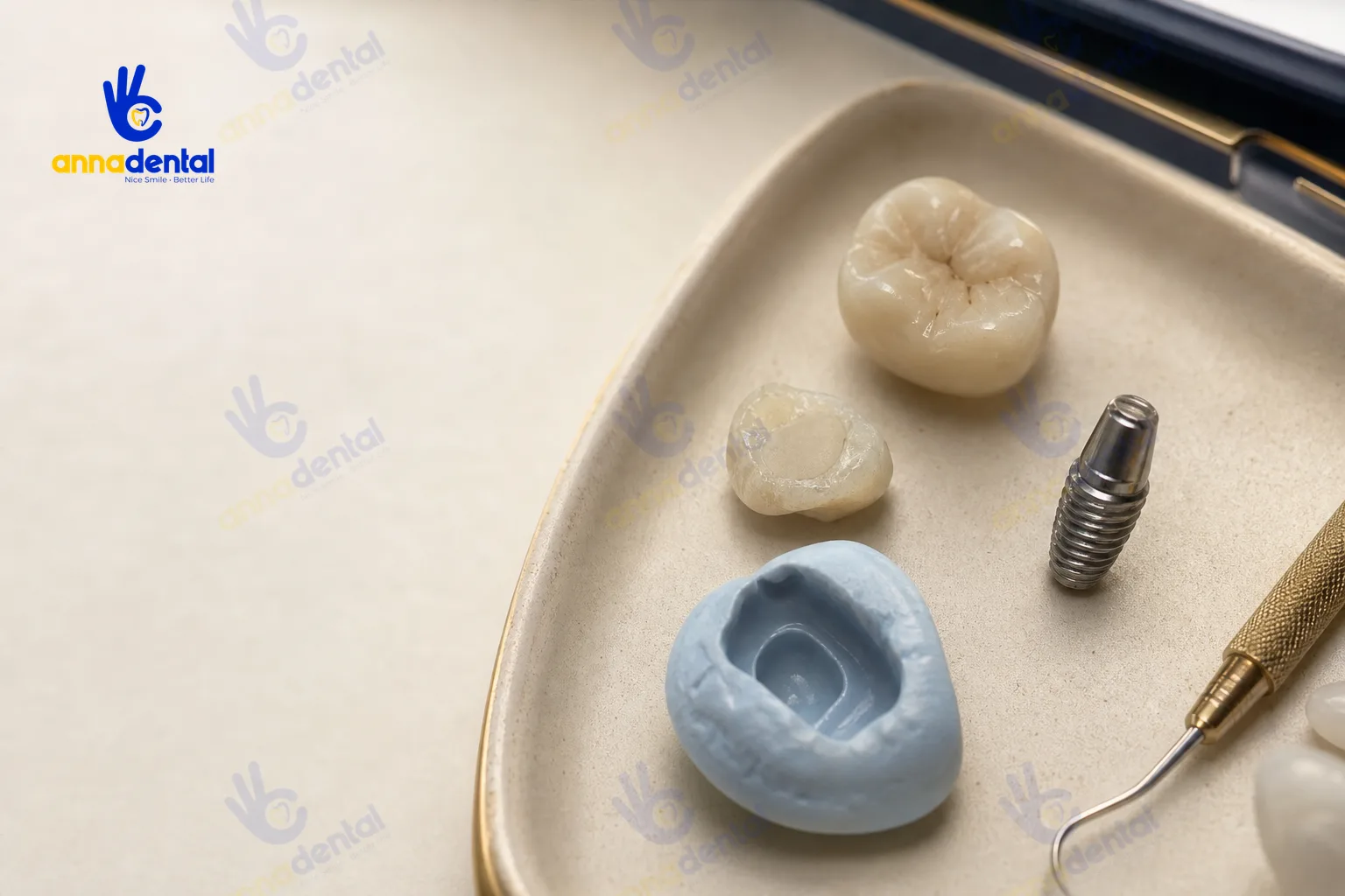 Các vật liệu phục hình răng cửa: trám, mão sứ, implant, mẫu răng điều trị tủy