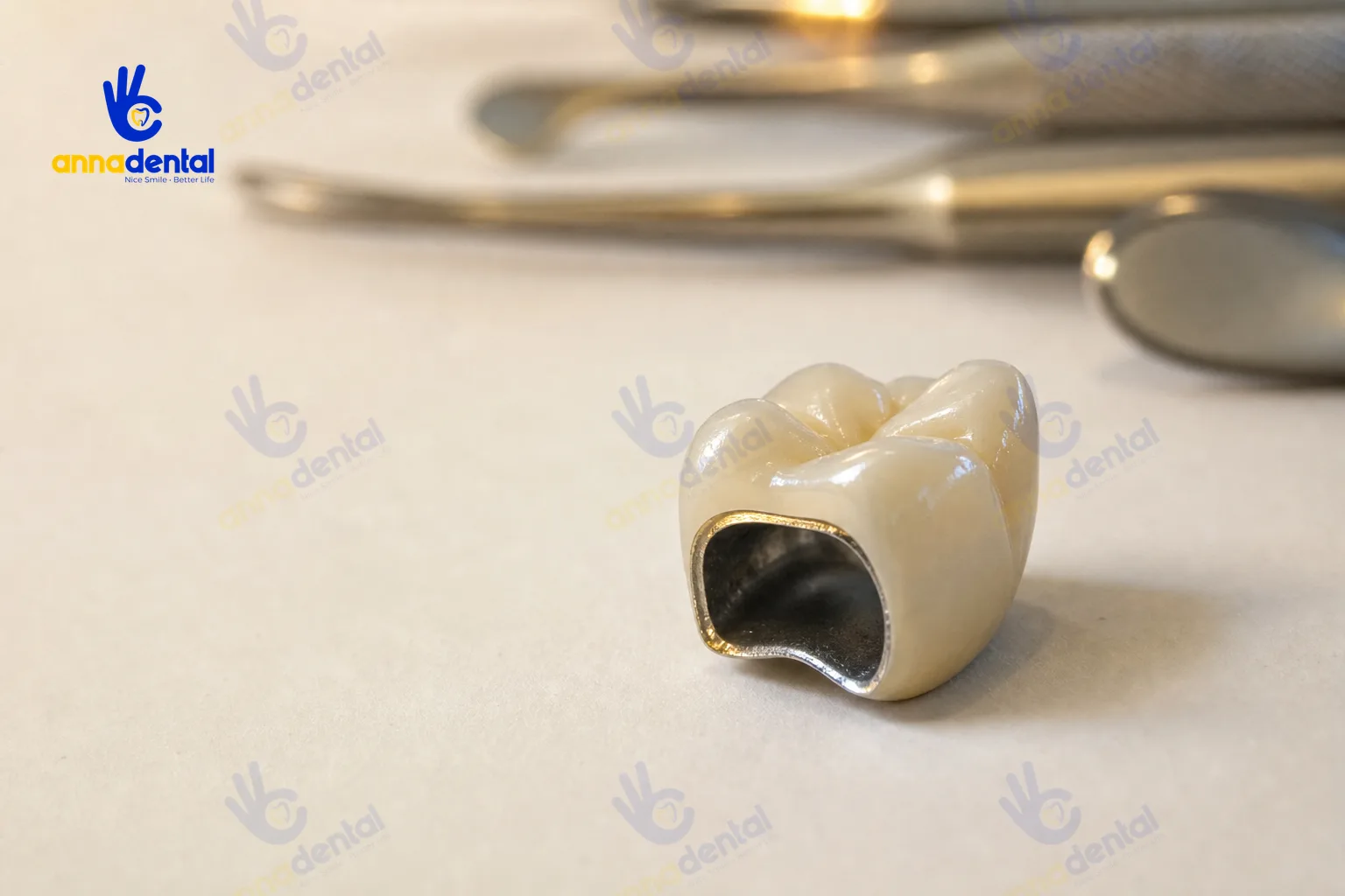 Răng sứ kim loại giá rẻ đặt trên nền trắng ngà, cận cảnh vật liệu bên trong