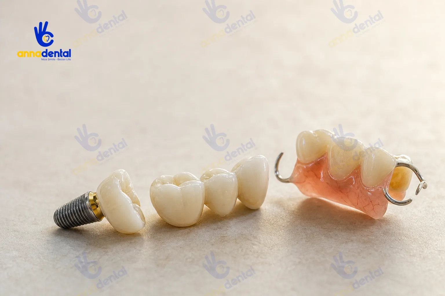 Ba loại phục hình răng hàm: trụ Implant, cầu răng sứ, hàm tháo lắp