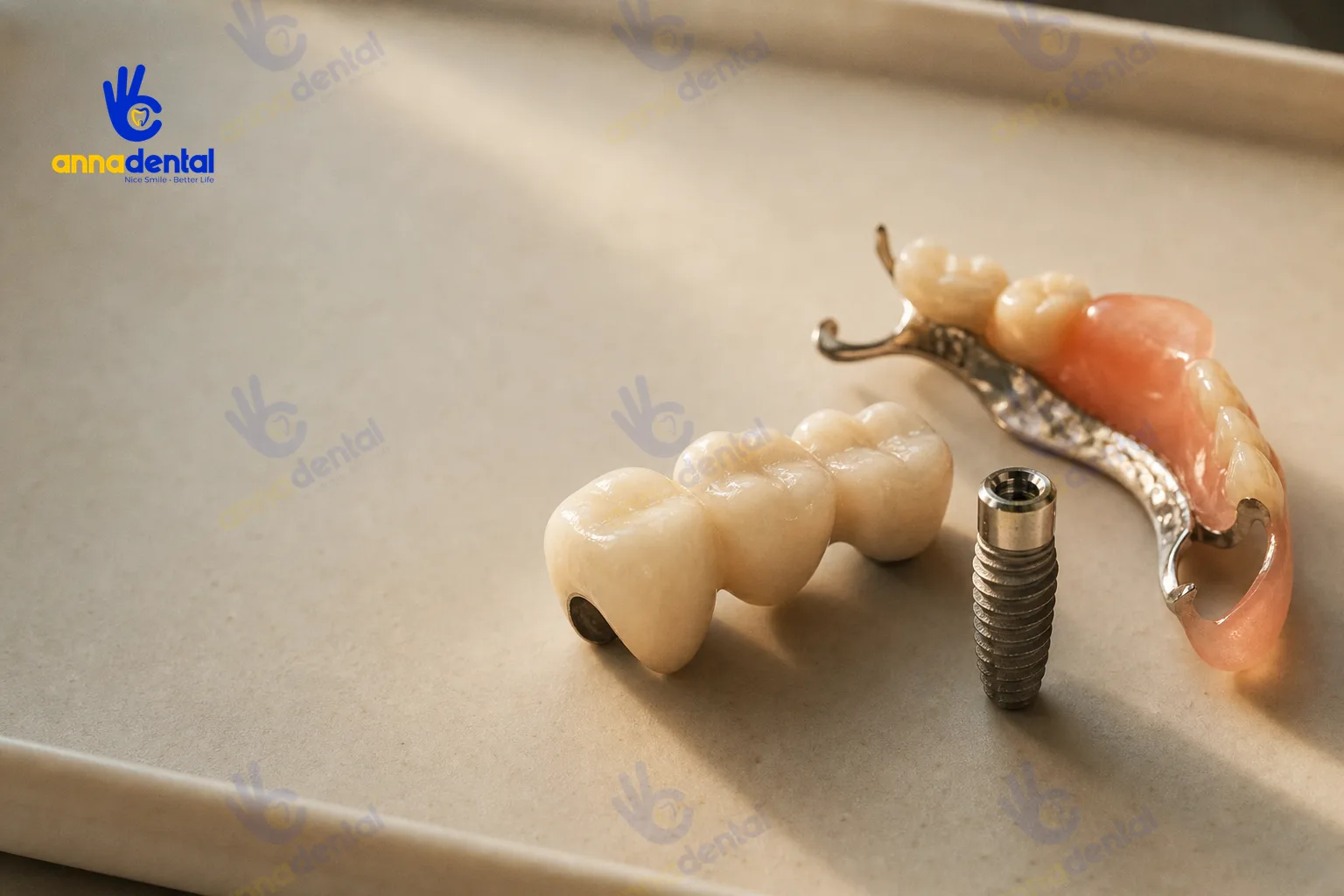 Cận cảnh các loại phục hình: trụ Implant, cầu răng, hàm giả tháo lắp
