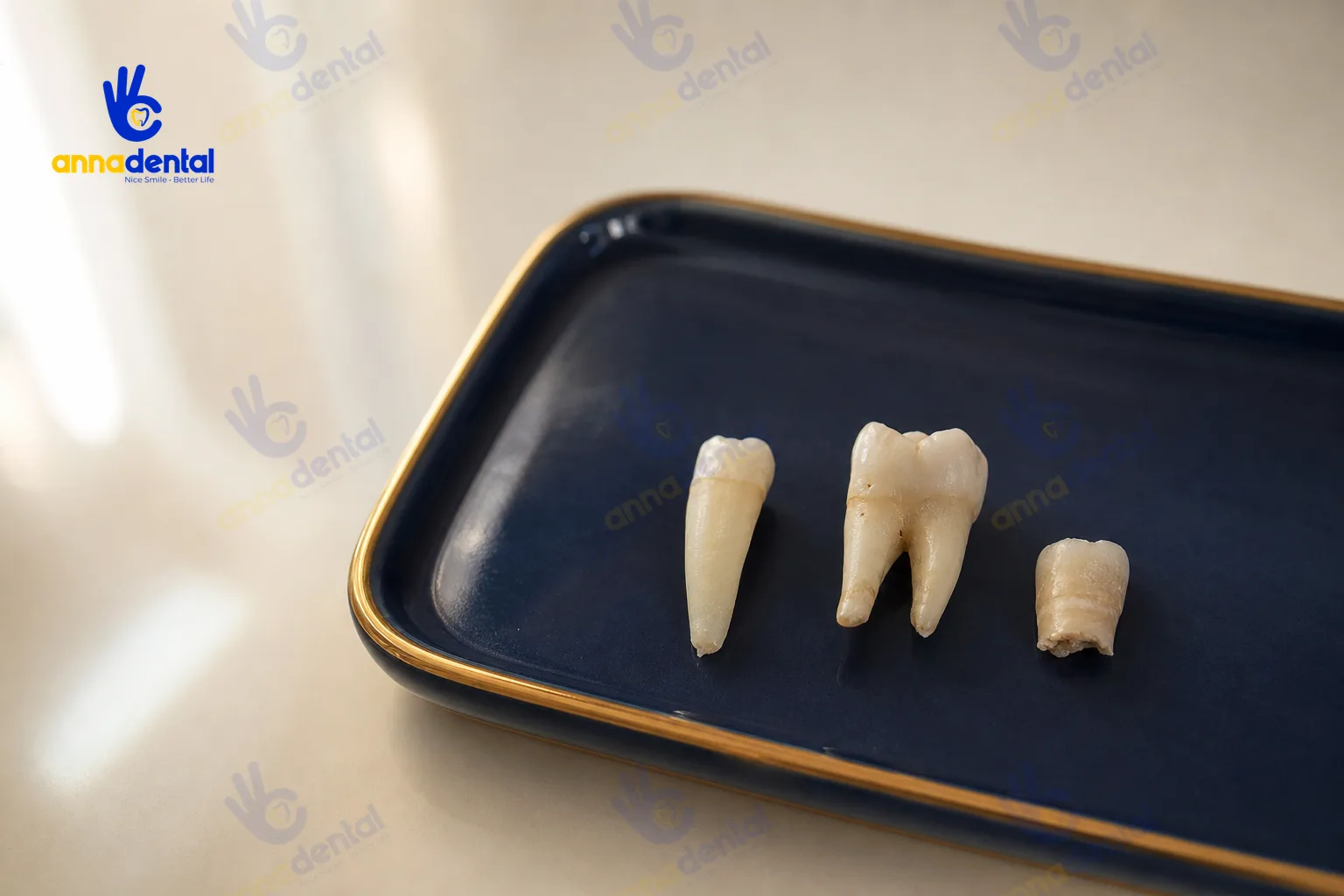 So sánh cấu trúc răng cửa, răng hàm và chân răng còn sót