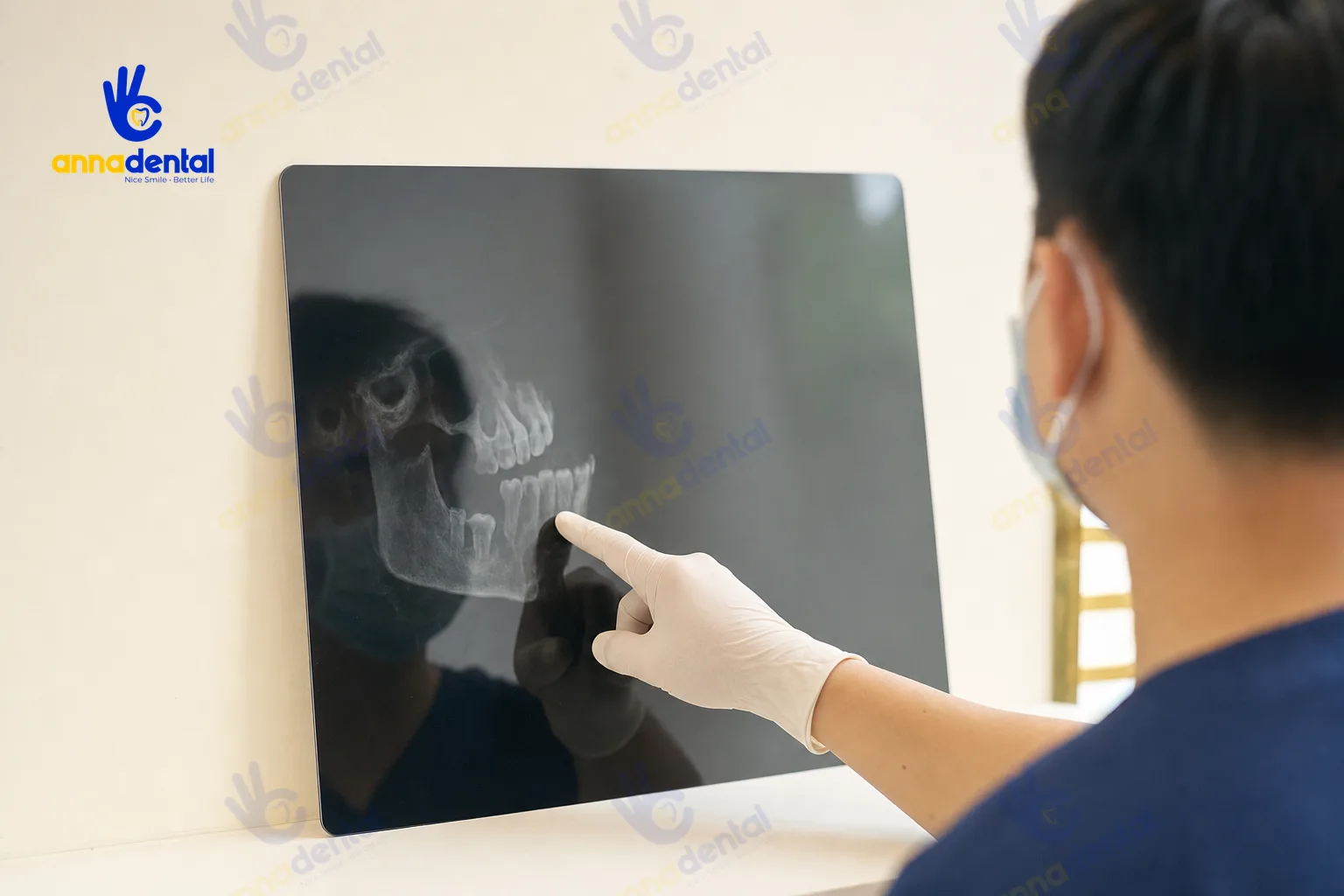 Bác sĩ đang chỉ vào hình ảnh CT Cone Beam để đánh giá xương hàm và lên kế hoạch nhổ răng bao lâu thì cấy Implant được