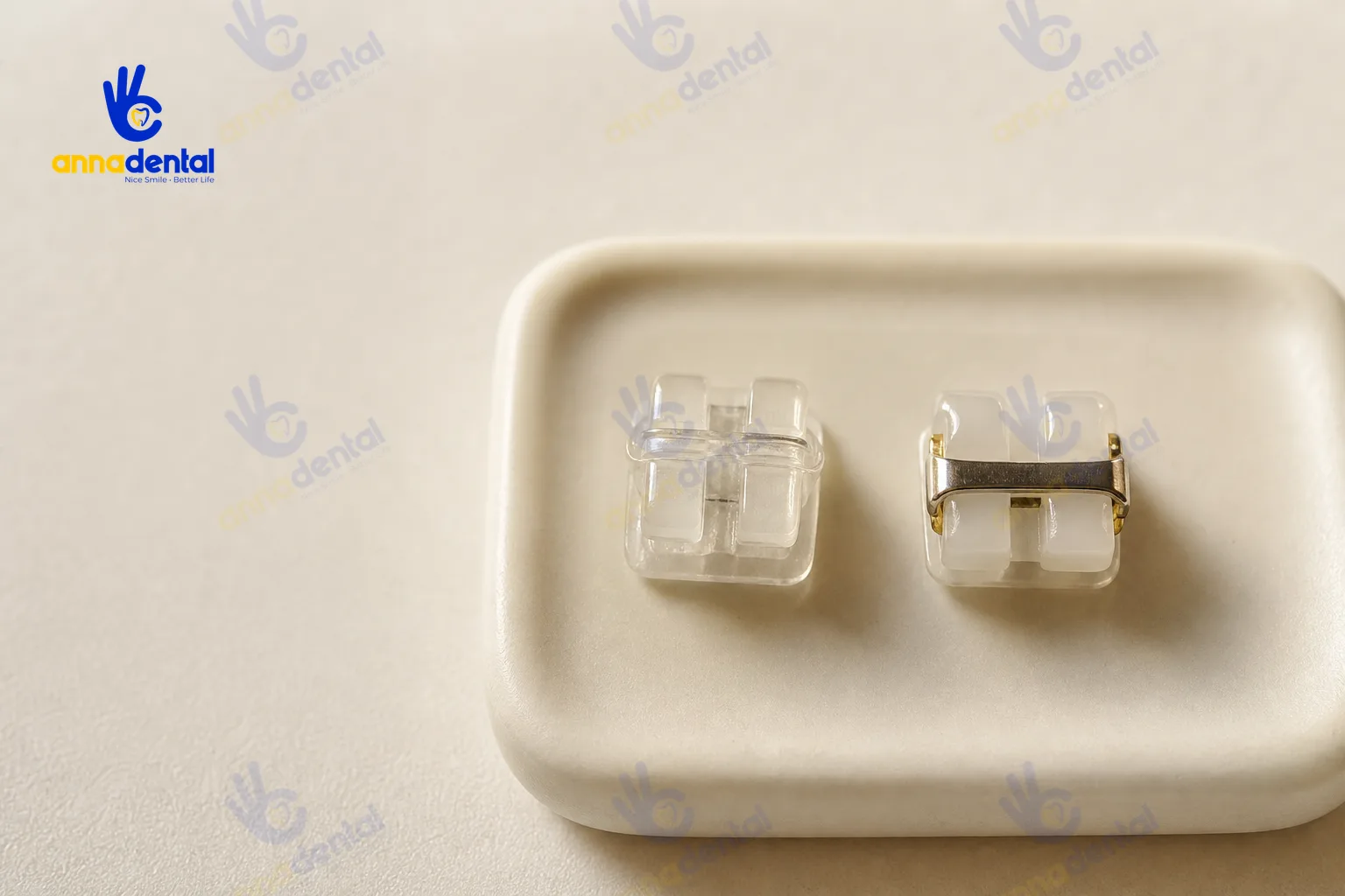 Hai loại mắc cài sứ thường và tự buộc đặt trên khay sạch sáng