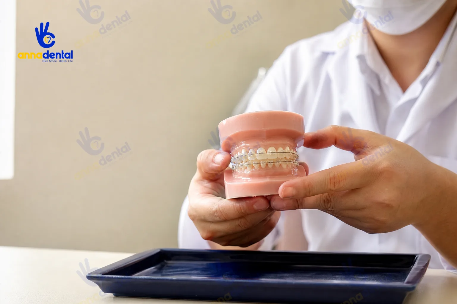 Bác sĩ cầm mô hình răng gắn mắc cài sứ minh hoạ niềng răng mắc cài sứ