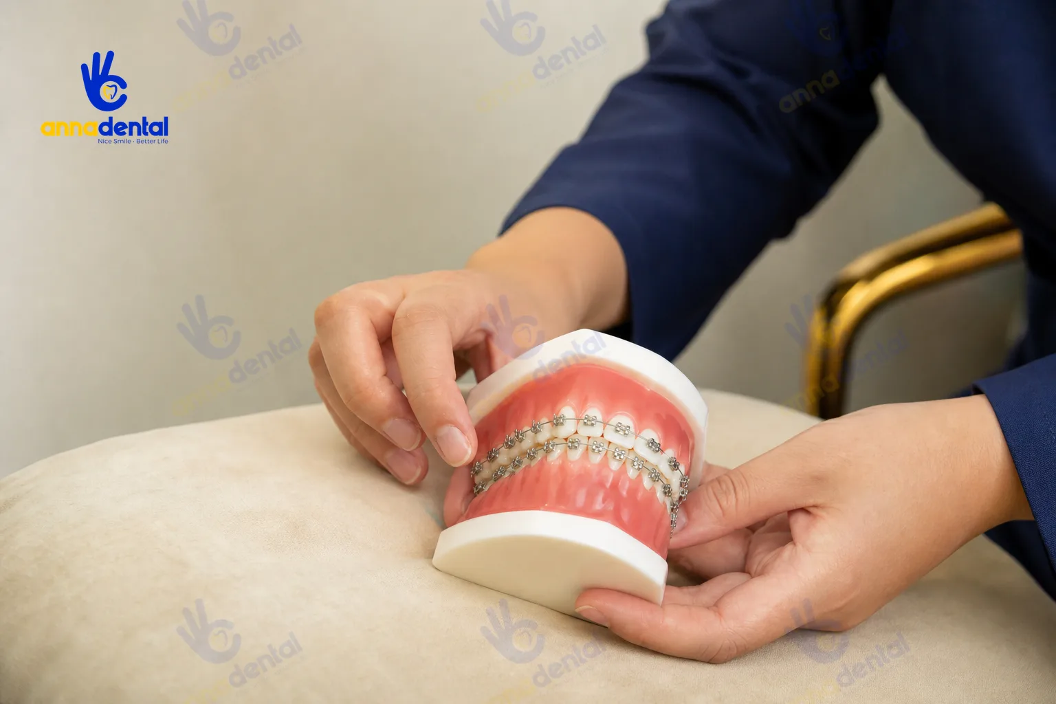 Mô phỏng giai đoạn đầu răng tạm thời lộn xộn sau khi gắn mắc cài