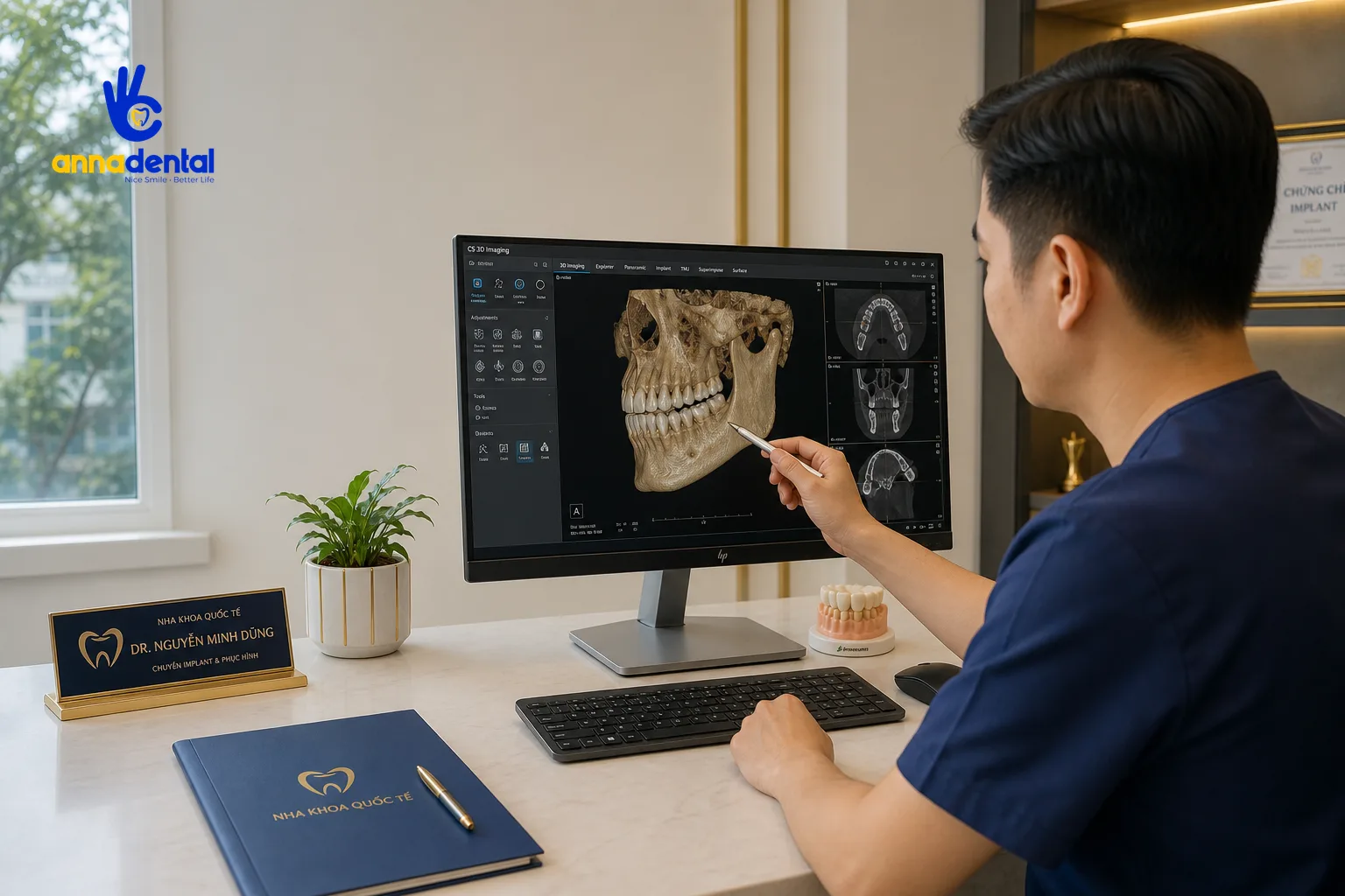 Bác sĩ kiểm tra phim CT Cone Beam trước khi lên phác đồ cấy Implant