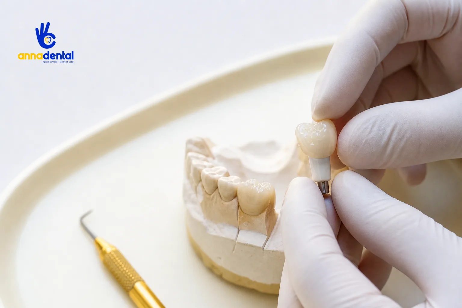 Bàn tay kỹ thuật viên gắn mão sứ lên trụ Implant trên mẫu hàm