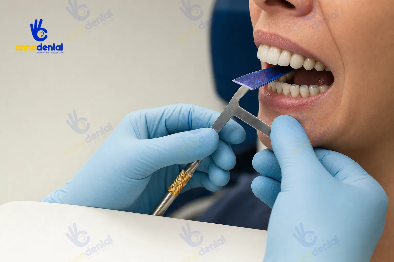 Bác sĩ kiểm tra khớp cắn răng bọc sứ bằng giấy cắn chuyên dụng