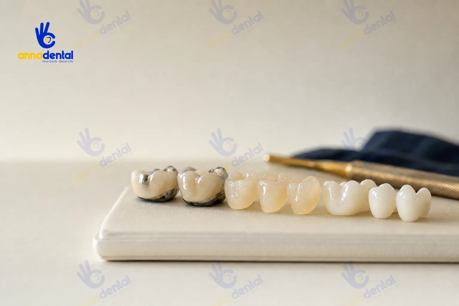 Các loại mão sứ khác nhau dùng cho răng đã lấy tủy