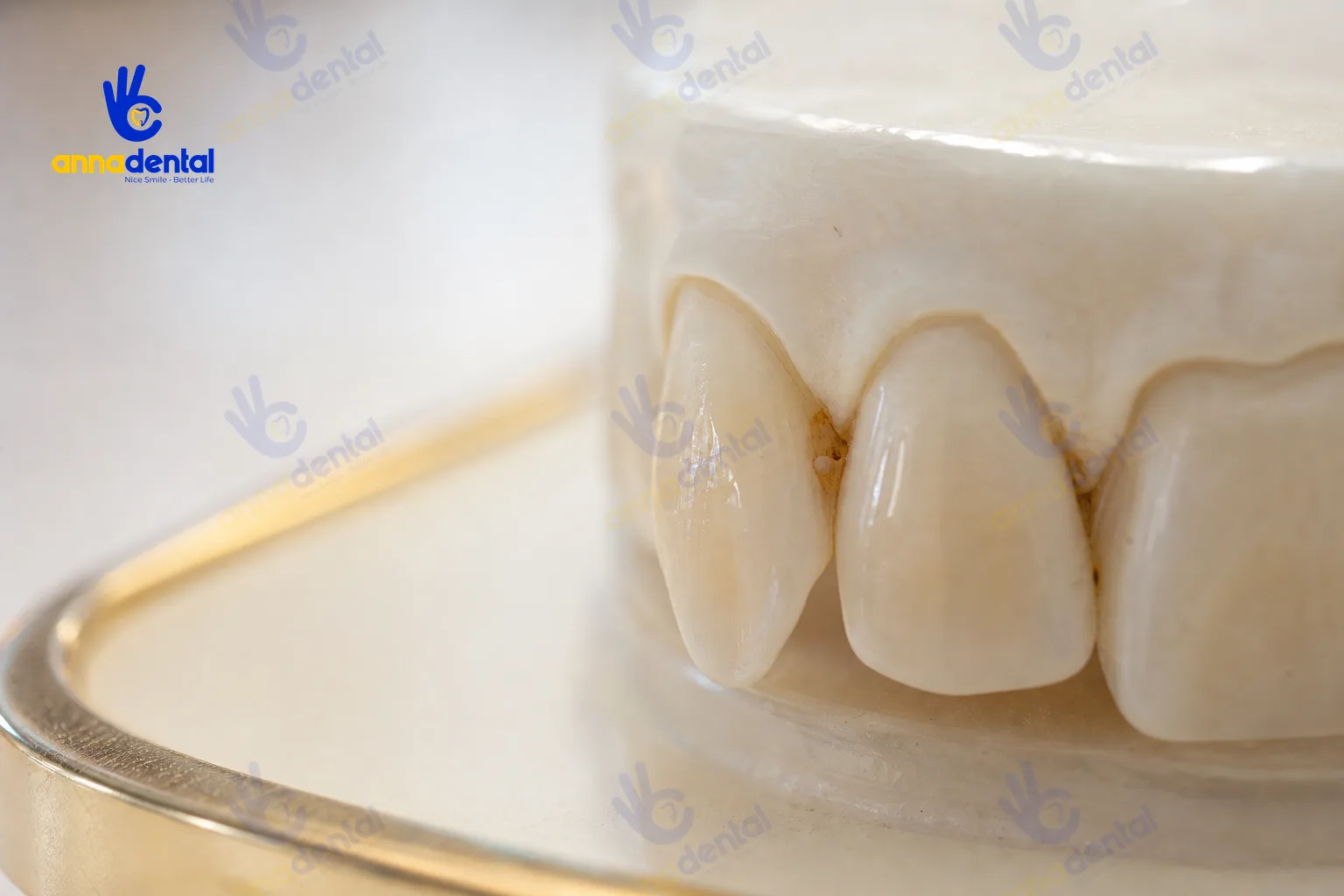 Cận cảnh răng khểnh và khe giắt thức ăn trên mẫu hàm