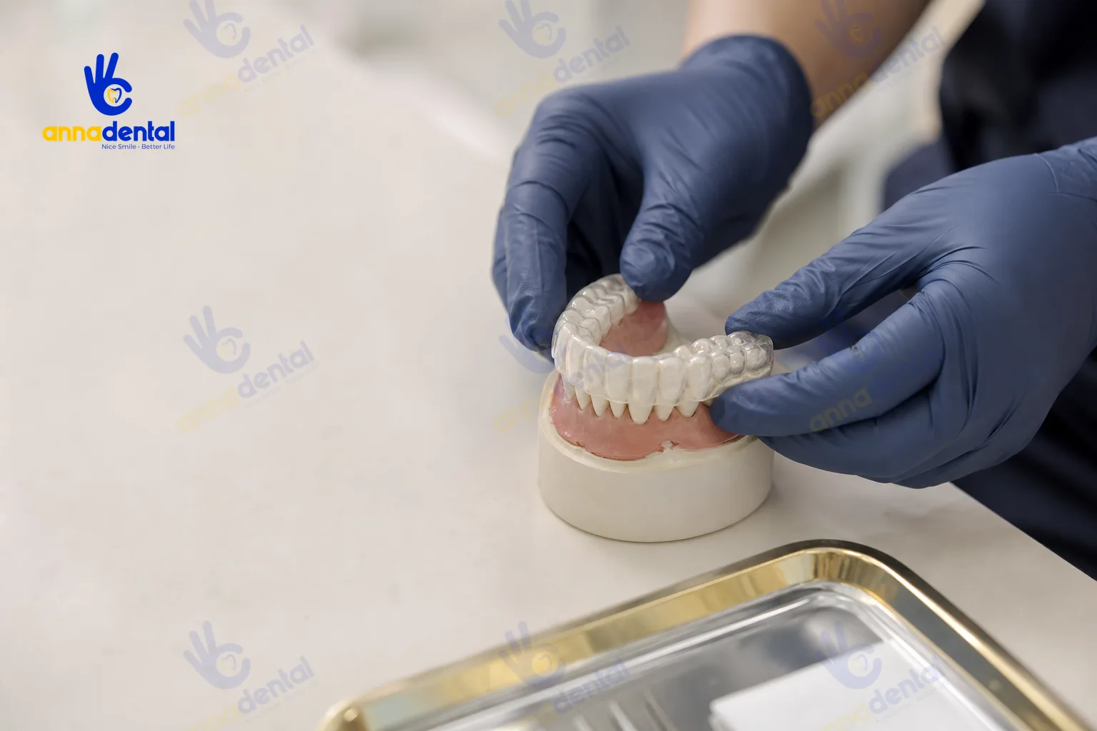 Tay kỹ thuật viên chuẩn bị nẹp răng trên mẫu hàm để điều trị răng lung lay