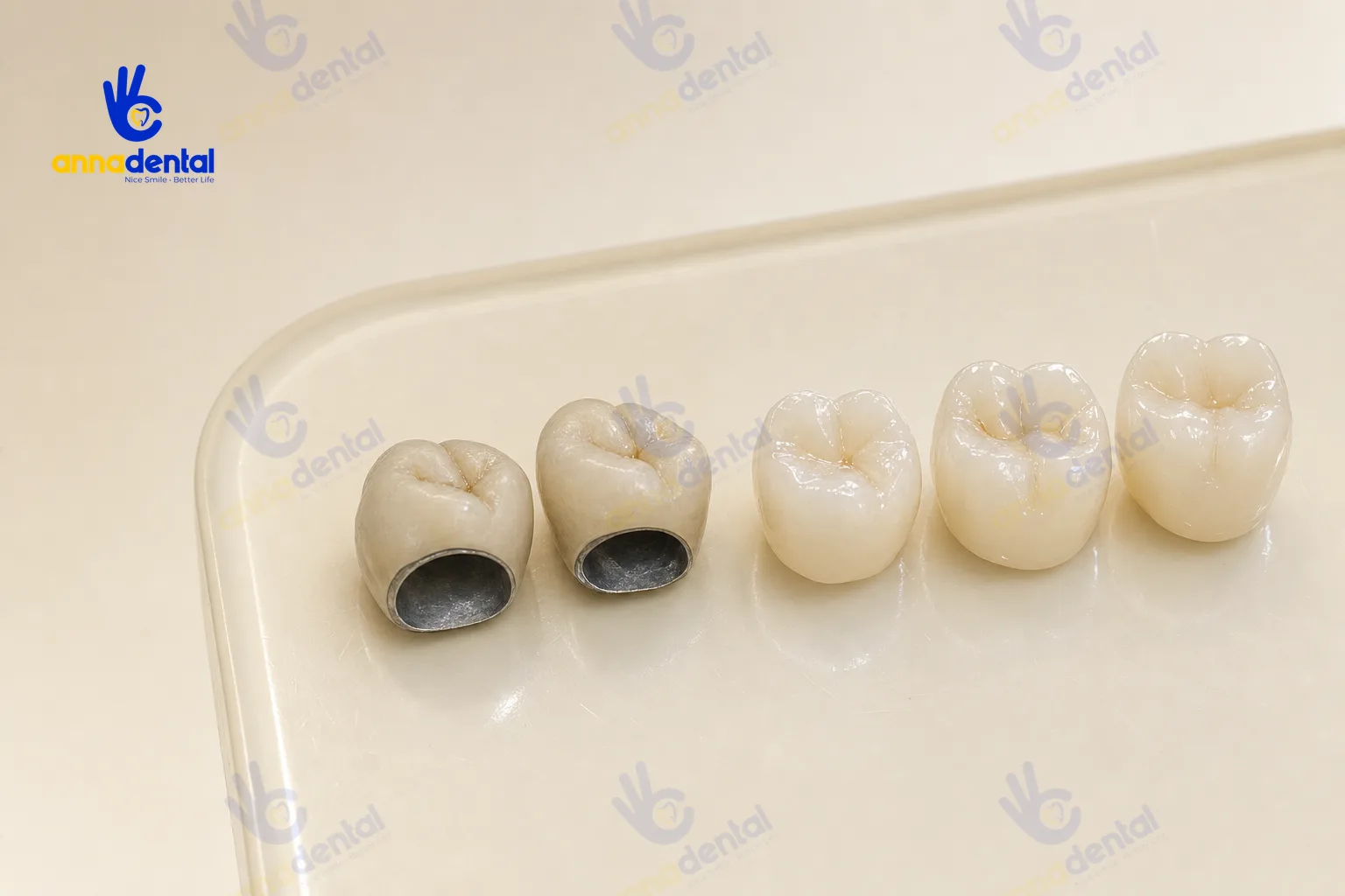 Mẫu răng toàn sứ và răng sứ kim loại đặt cạnh để so sánh