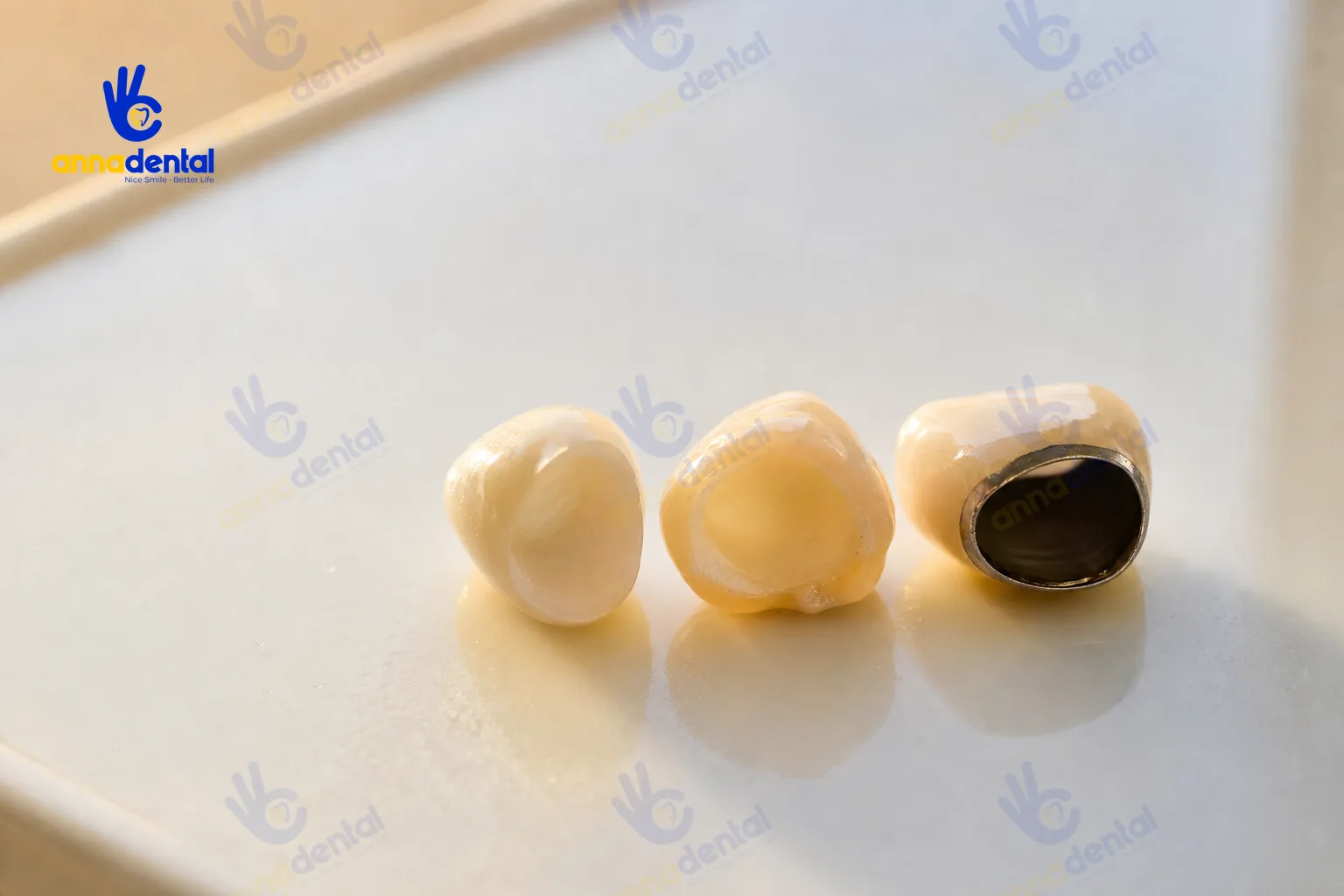 Ba mão răng sứ thật, mô tả rõ bề mặt cho câu hỏi răng sứ có sửa được không