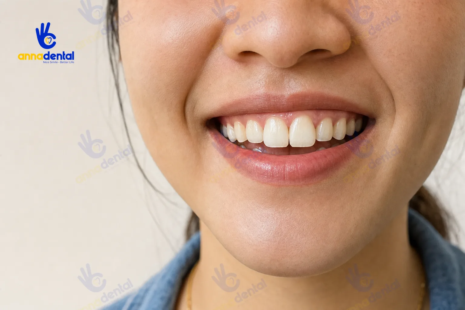 Cận cảnh nụ cười với hai răng thỏ cửa trên nổi bật