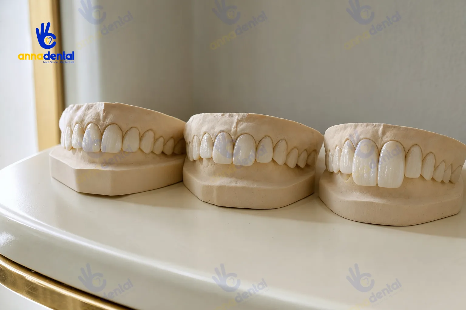 Ba mẫu hàm mô phỏng răng thỏ, răng hô và răng to bất thường
