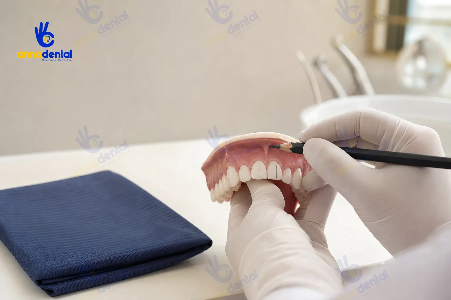 Bác sĩ đánh dấu lên mẫu hàm để thiết kế dáng răng thỏ