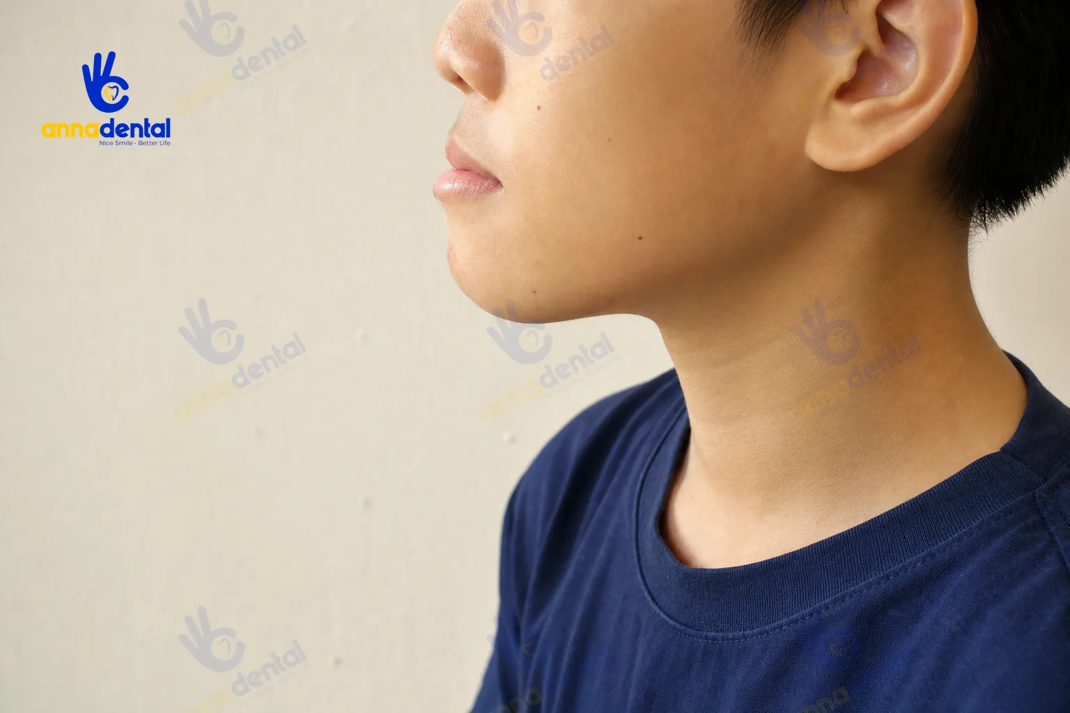 Nghiêng mặt trẻ em cho thấy tình trạng răng móm và cằm nhô