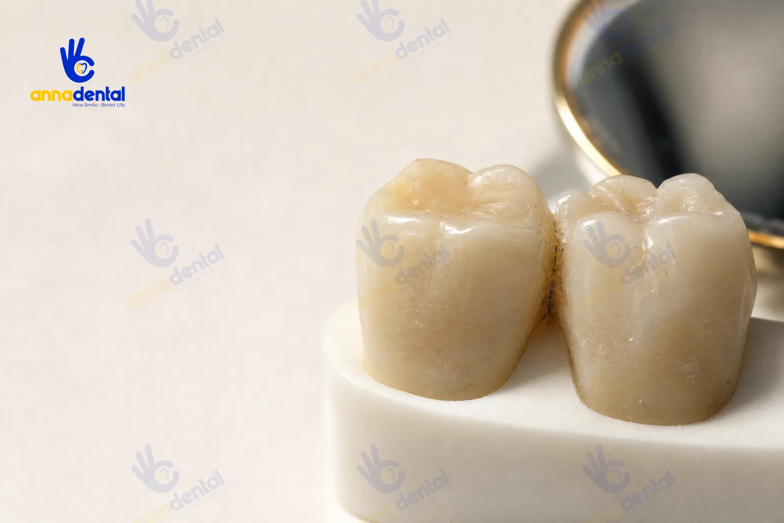 Sâu kẽ răng: dấu hiệu nhận biết sớm và hướng điều trị hiệu quả