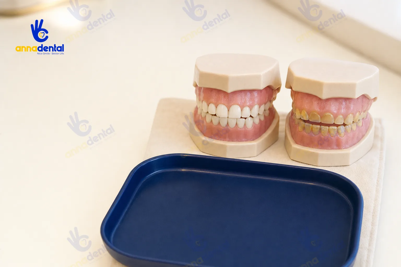 Mô hình so sánh răng sữa khỏe mạnh và răng bị sún