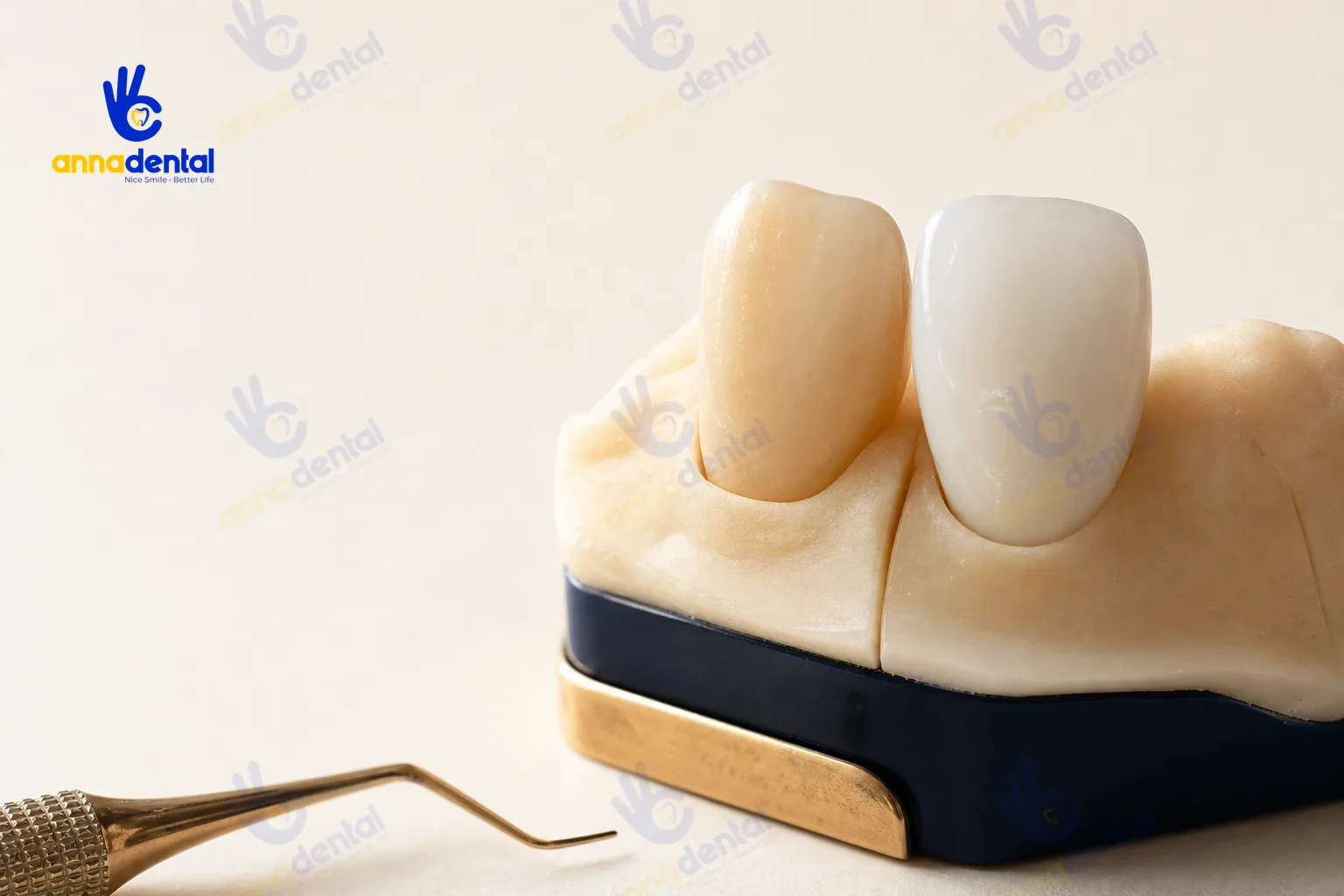 Ảnh cận cảnh mô hình răng thật cạnh răng sứ cho thấy khác biệt vật liệu